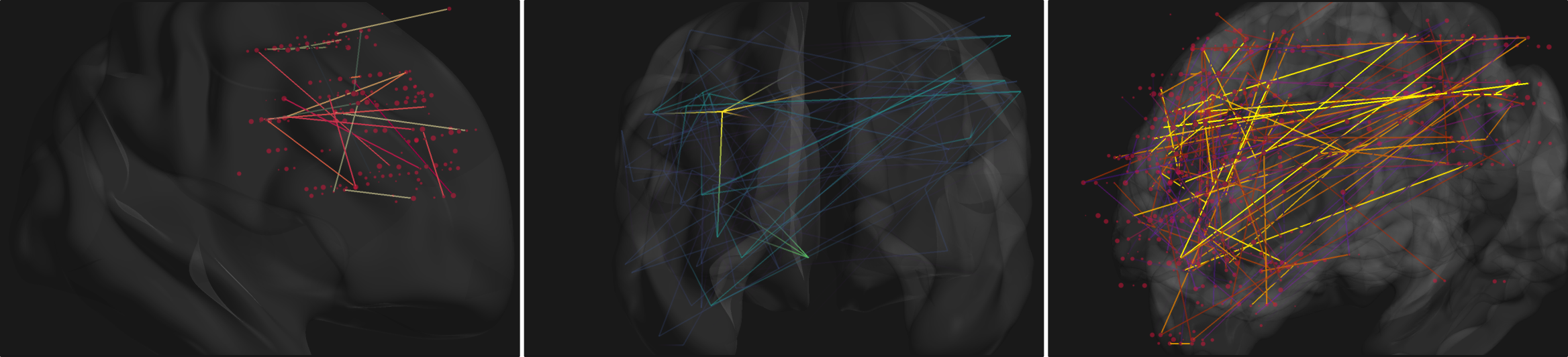 _images/brain_connect.png