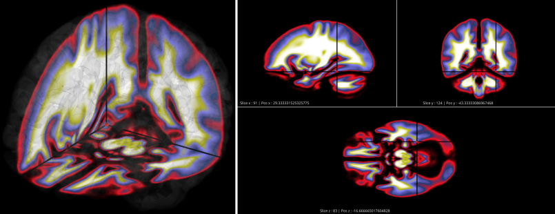 _images/brain_crossec.png