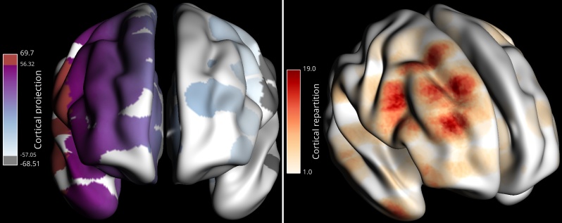 _images/brain_projection.png