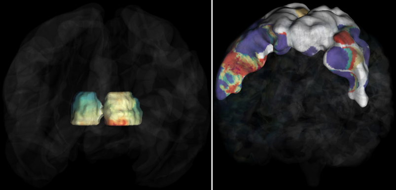 _images/brain_roi.png