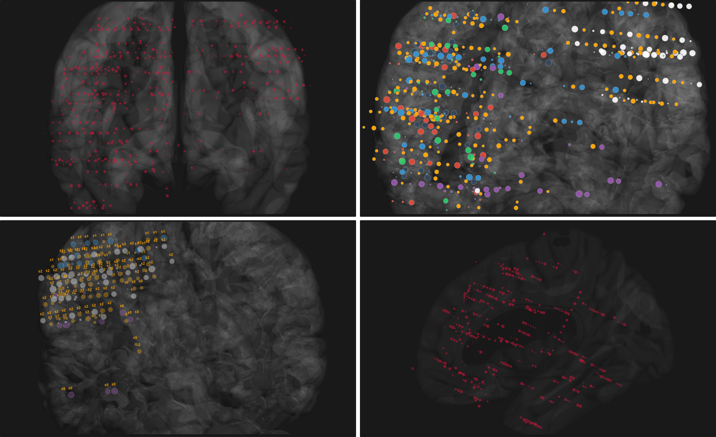 _images/brain_sources.png