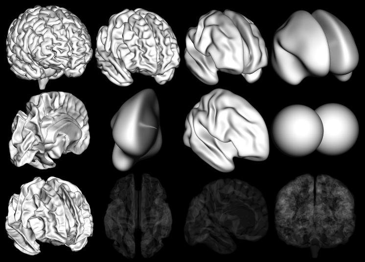 _images/brain_templates.png