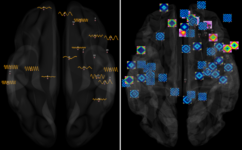 _images/brain_tspic.png
