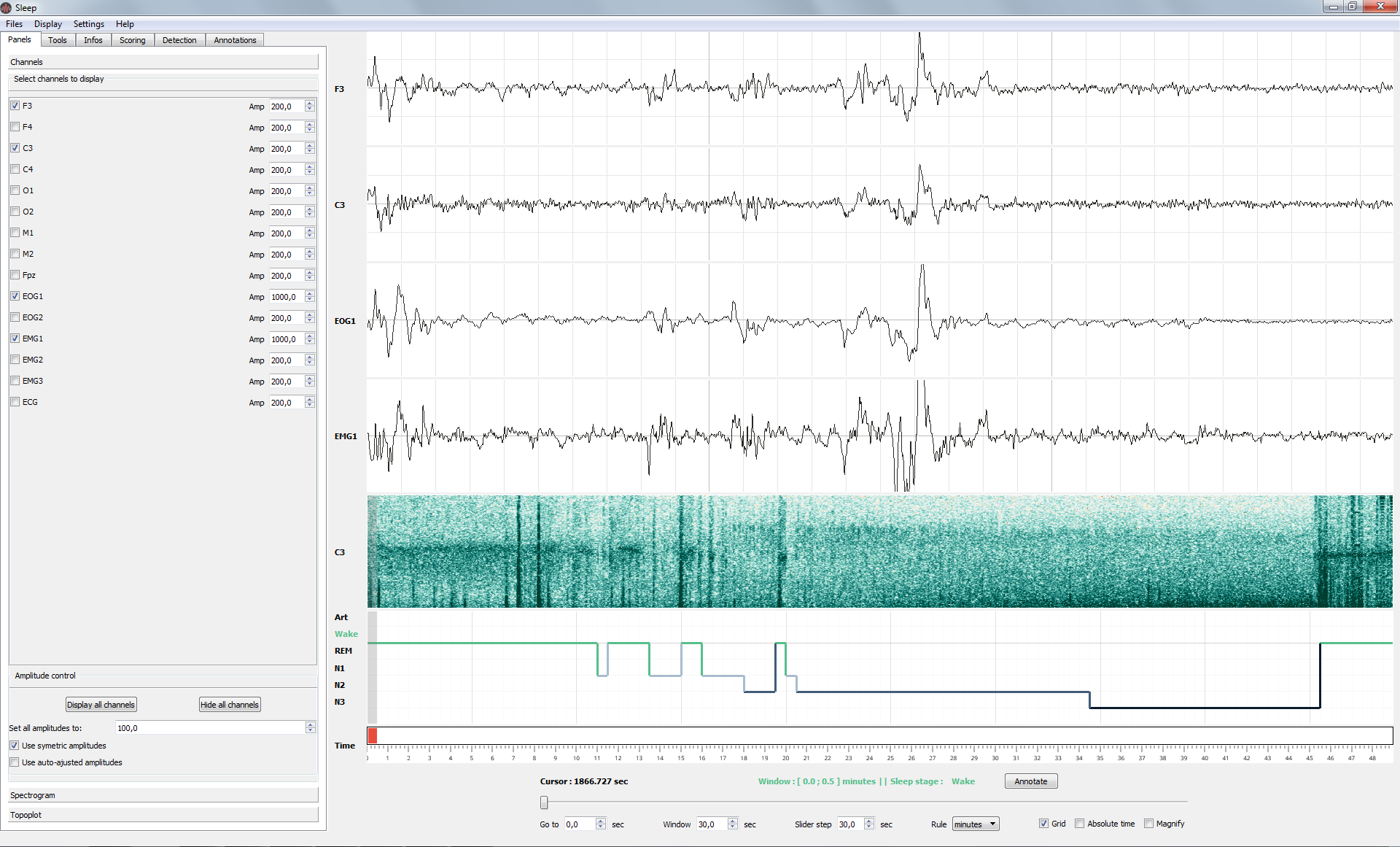 ../../_images/ex_LoadMatlab.png