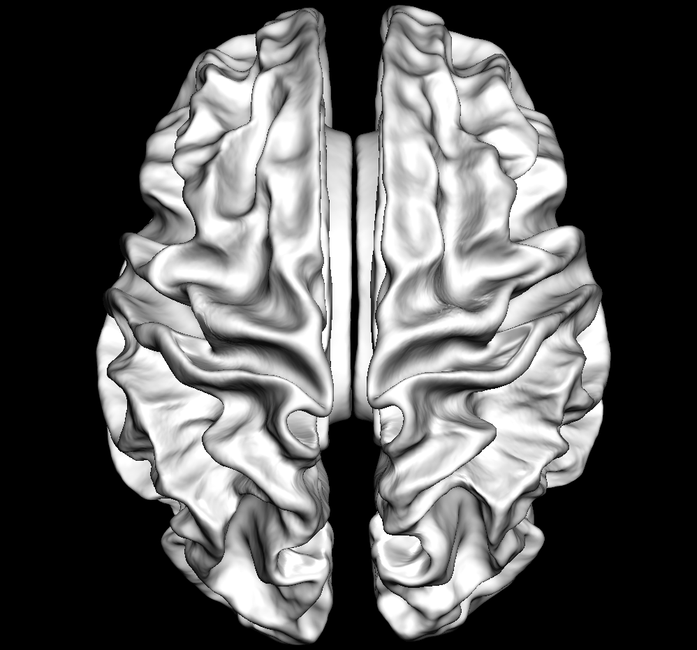 ../../_images/ex_add_brain_template.png