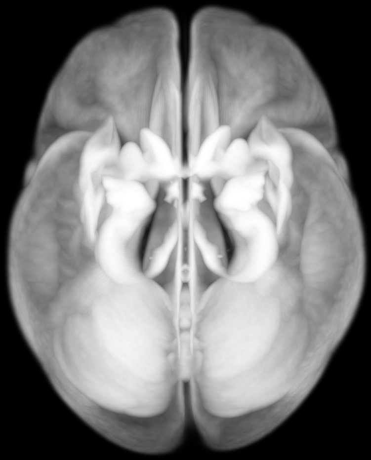 ../../_images/ex_add_nifti.png