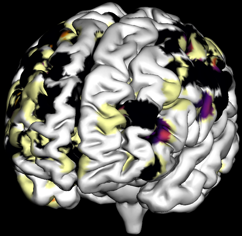 ../../_images/ex_brain_screenshot.png