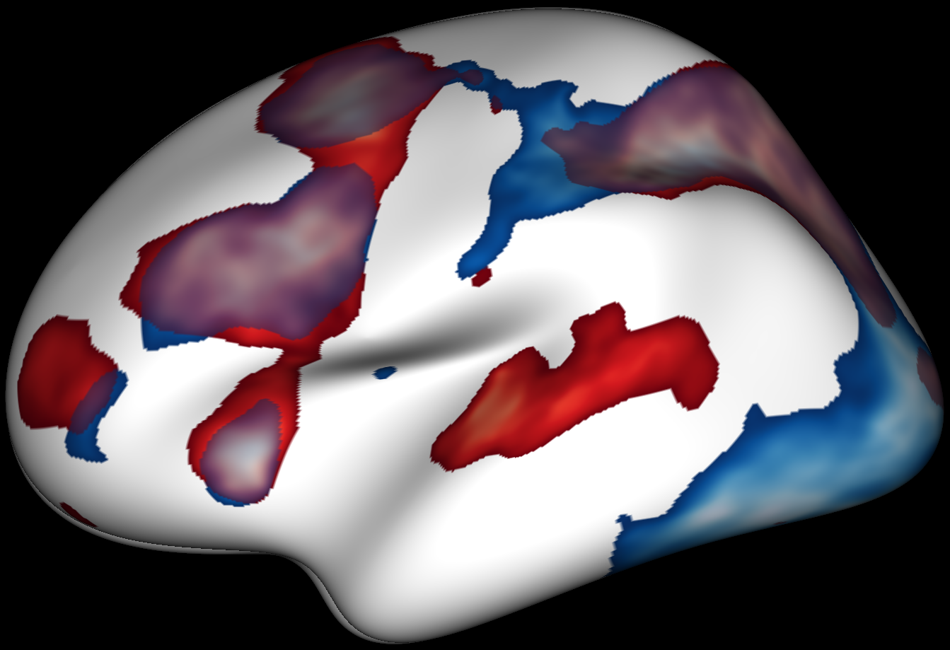 ../../_images/ex_eegmeg_conjunction_map.png