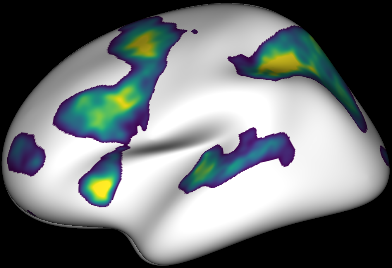 ../../_images/ex_eegmeg_fmri_activations.png