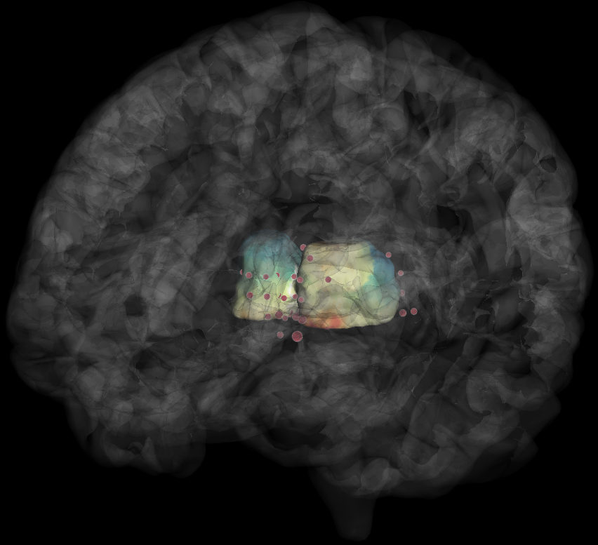 ../../_images/ex_region_of_interest.png