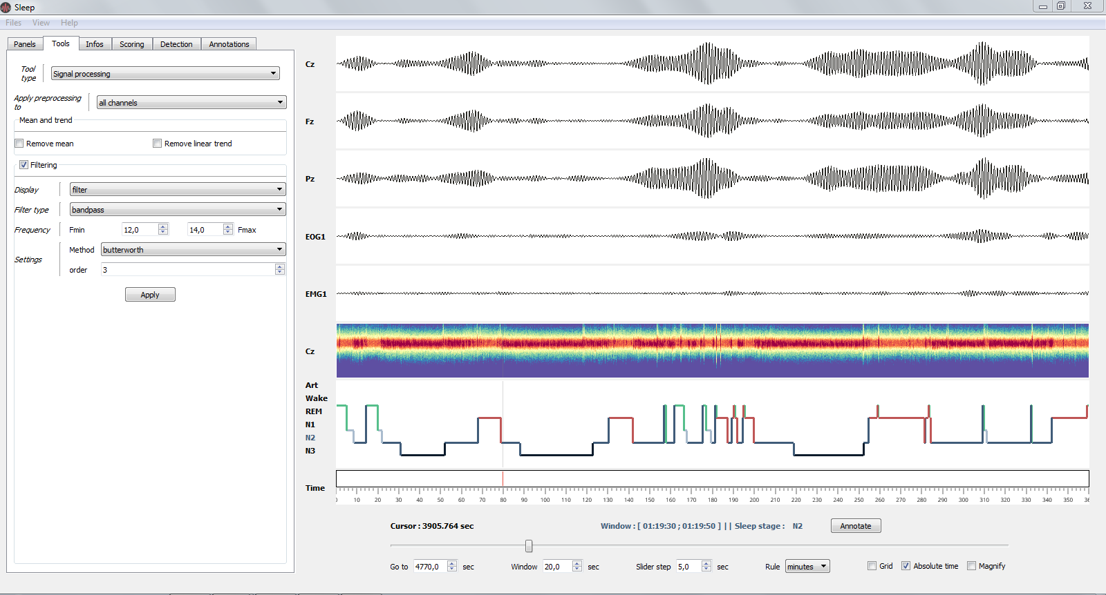 _images/sleep_filtering.png