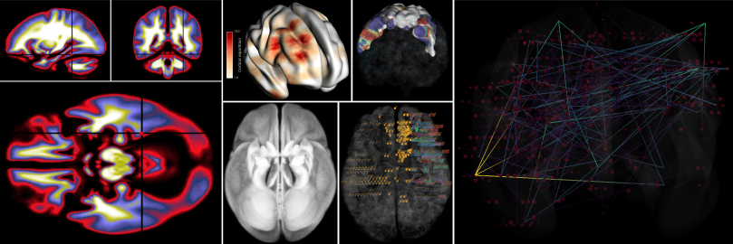 _static/brain/brain_description.png